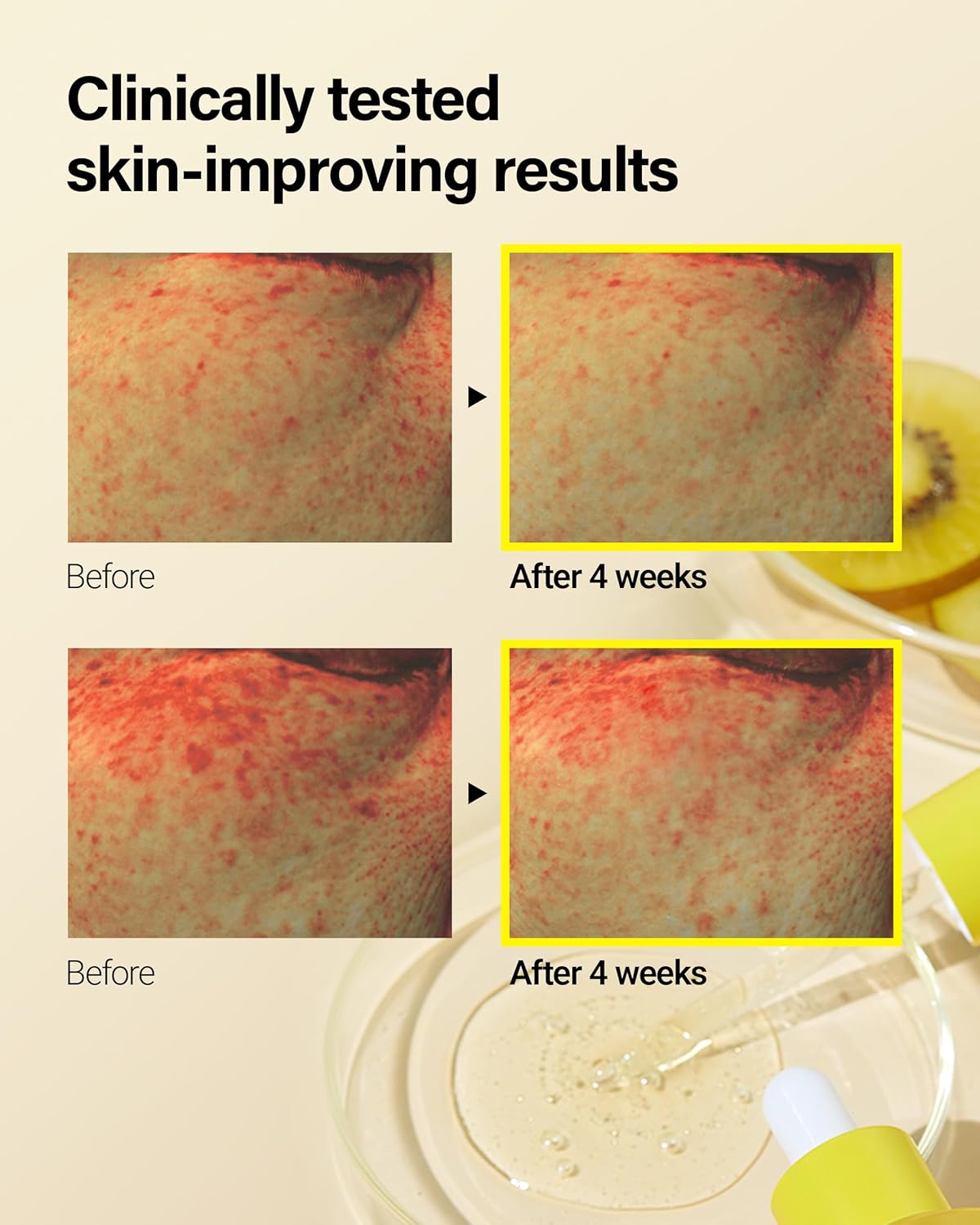 Glow & Repair Duo: Gold Kiwi + CeraBarrier