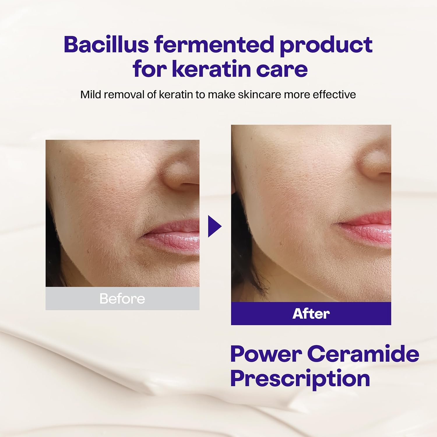 Vita-Ceramide Synergy Bundle