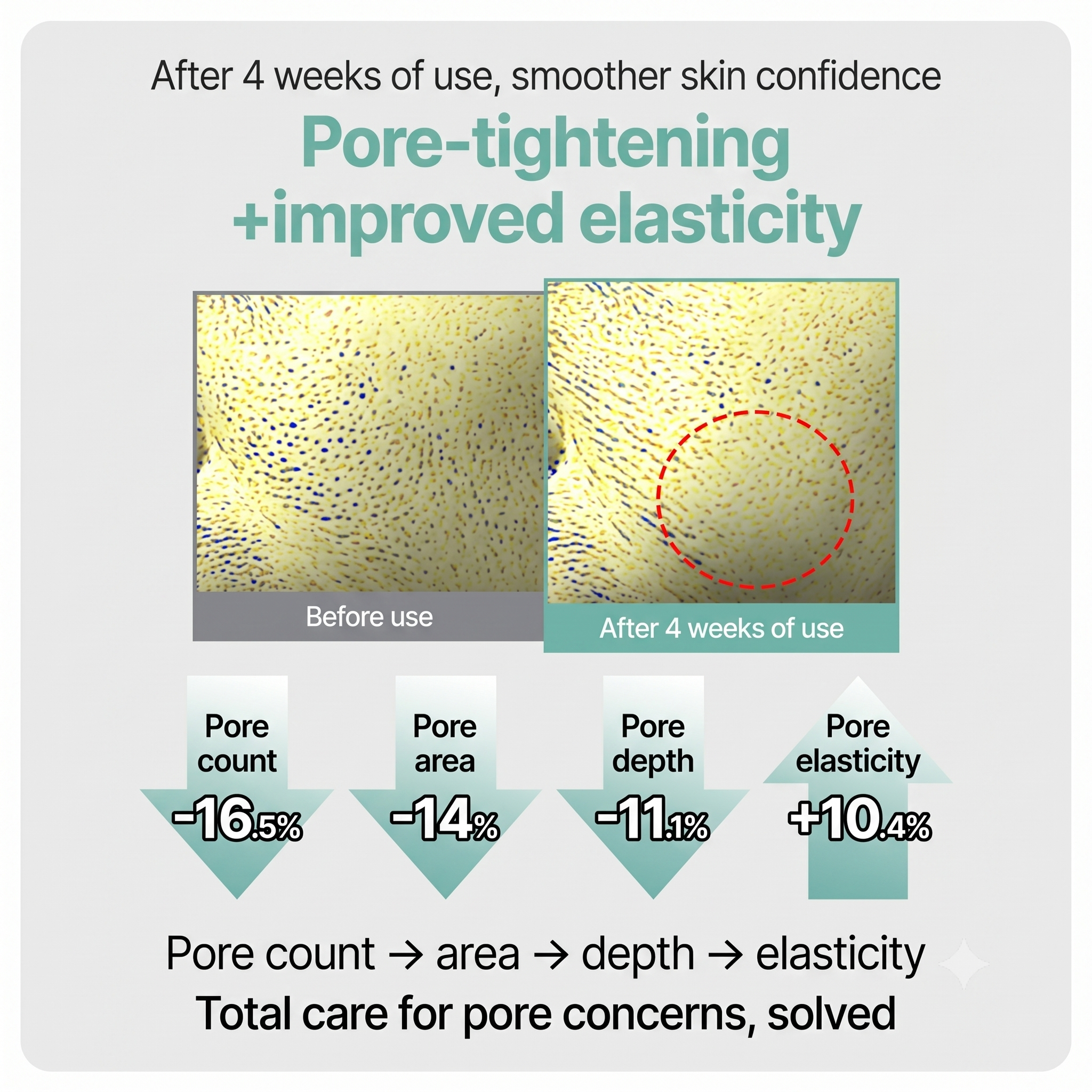 ENPRANI Botaretinol Peptide Wrinkle Care Cream 50ml (with Cooling Roller Applicator)
