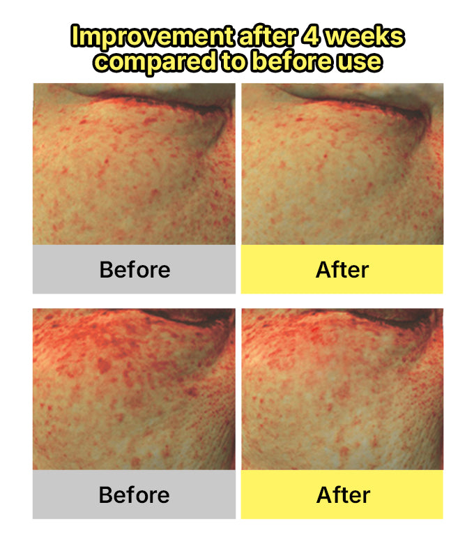 Before and after Gold Kiwi Vita C+ Serum – reduced dark spots and improved glow