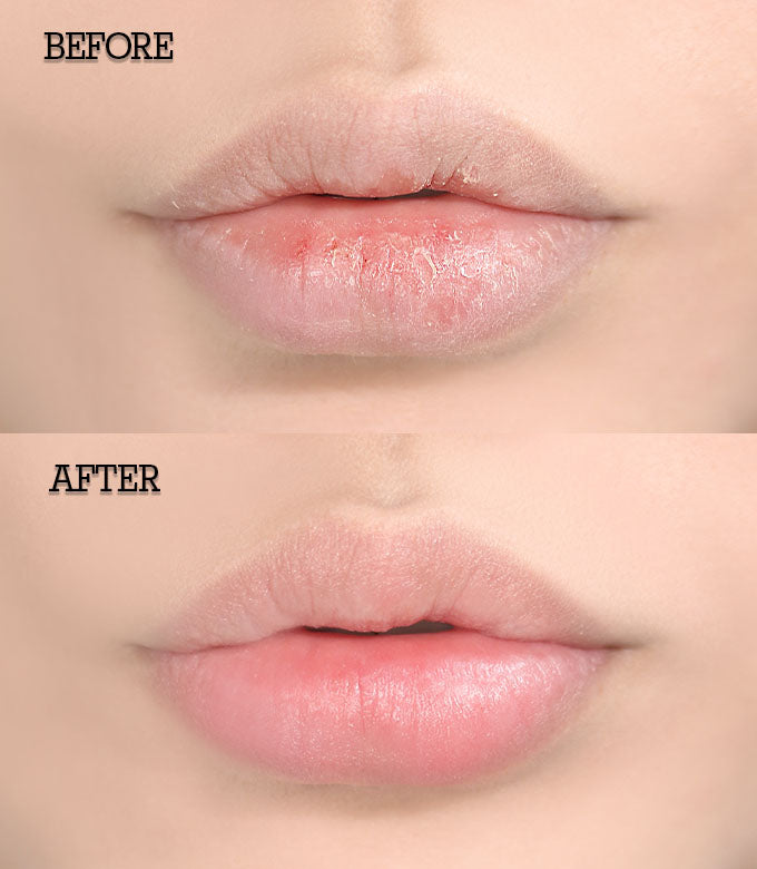 Before and after using enrichment lip gel for overnight soothing and hydration